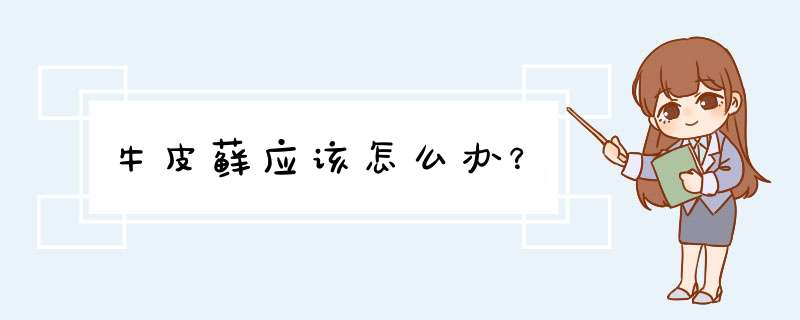 牛皮藓应该怎么办？,第1张