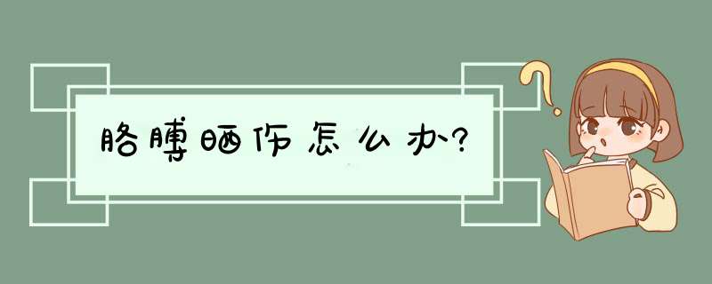 胳膊晒伤怎么办?,第1张